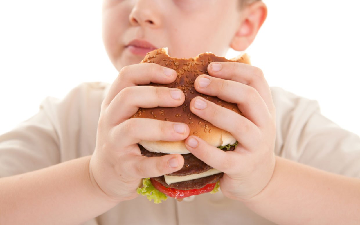 Image result for childhood obesity